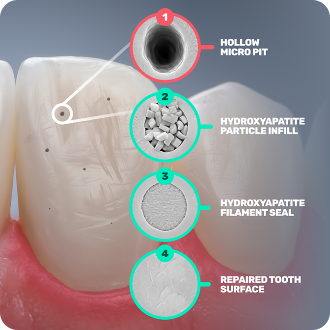 HAp toothpaste to protect enamel and smooth surfaces